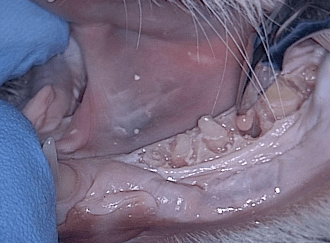 Root tip pick removing fragment