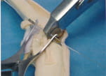 tensioning-device-demo