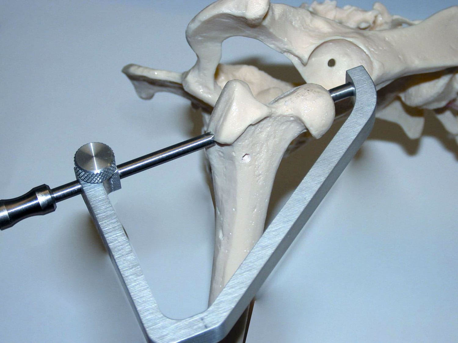 CLM Clamp on a bone